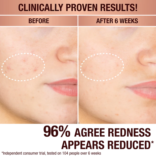 DARK SPOT SERUM & CHARLOTTE’S MAGIC CREAM DUO SKINCARE KIT 7 DARK SPOT SERUM & CHARLOTTE’S MAGIC CREAM DUO SKINCARE KIT - Image 5