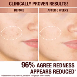 DARK SPOT CORRECTING RADIANCE RECOVERY SERUM 30 ML -Charlotte Tillbury Store PLP B A SUBJECT5 1x1 x1 2