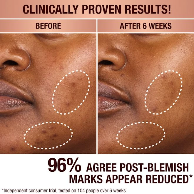 DARK SPOT SERUM & CHARLOTTE’S MAGIC CREAM DUO SKINCARE KIT 6 DARK SPOT SERUM & CHARLOTTE’S MAGIC CREAM DUO SKINCARE KIT - Image 4