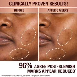 DARK SPOT CORRECTING RADIANCE RECOVERY SERUM 30 ML -Charlotte Tillbury Store PLP B A TEYONNA 1x1 2